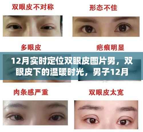男子雙眼皮恢復(fù)之旅，冬季溫暖時(shí)光與友情的碰撞