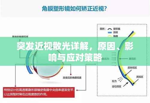 突發近視散光詳解，原因、影響與應對策略