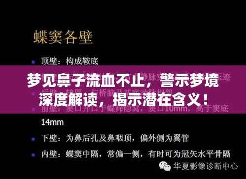 夢見鼻子流血不止，警示夢境深度解讀，揭示潛在含義！