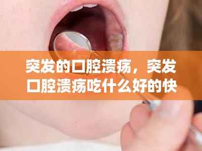 突發的口腔潰瘍，突發口腔潰瘍吃什么好的快 