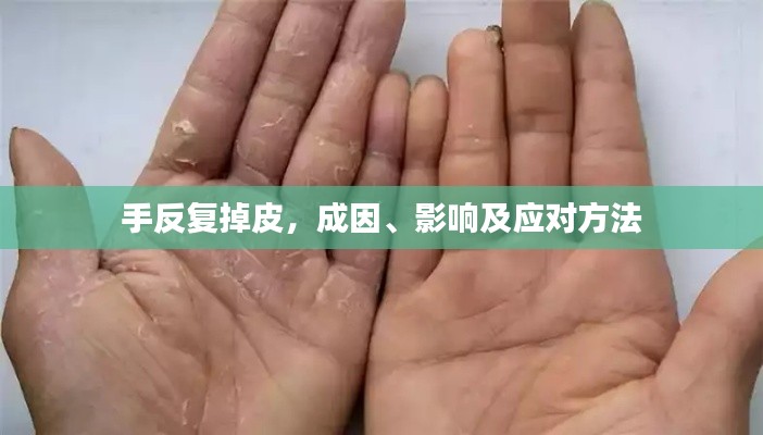 手反復掉皮，成因、影響及應對方法