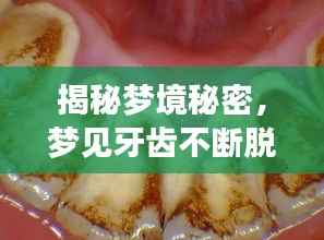 揭秘夢境秘密，夢見牙齒不斷脫落的背后含義