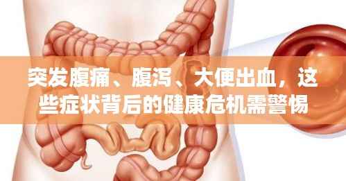突發腹痛、腹瀉、大便出血，這些癥狀背后的健康危機需警惕！