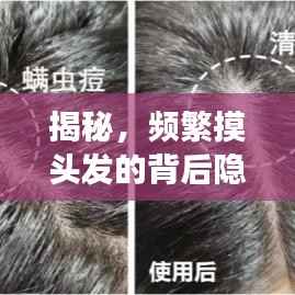 揭秘，頻繁摸頭發(fā)的背后隱藏的故事與心理解讀