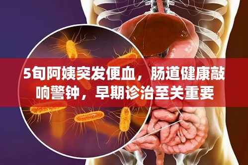 5旬阿姨突發便血，腸道健康敲響警鐘，早期診治至關重要