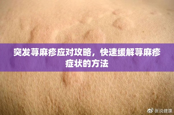 突發蕁麻疹應對攻略，快速緩解蕁麻疹癥狀的方法
