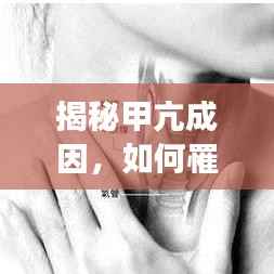 揭秘甲亢成因，如何罹患甲狀腺功能亢進？