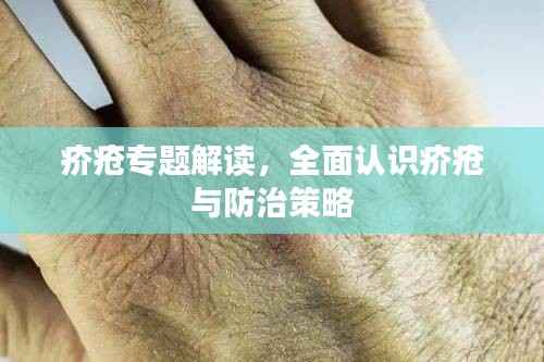 疥瘡專題解讀，全面認識疥瘡與防治策略