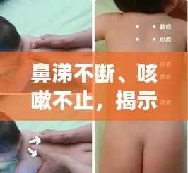 鼻涕不斷、咳嗽不止，揭示癥狀背后的健康隱患