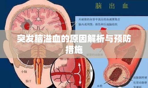 突發腦溢血的原因解析與預防措施