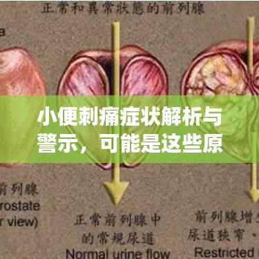 小便刺痛癥狀解析與警示，可能是這些原因?qū)е碌?，健康不容忽視? width=