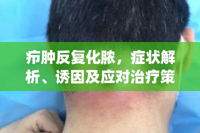 癤腫反復化膿，癥狀解析、誘因及應對治療策略