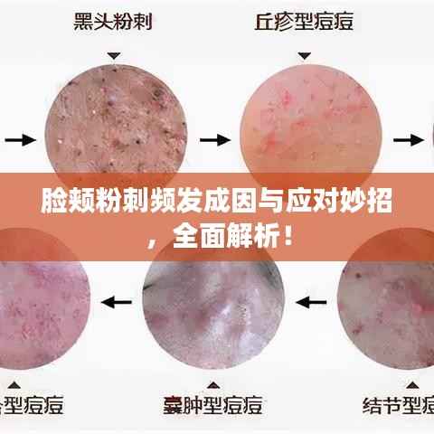 臉頰粉刺頻發(fā)成因與應(yīng)對(duì)妙招，全面解析！